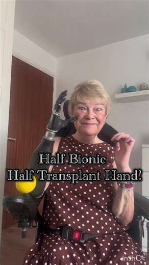 Innovative Bionic and Transplant Hand Update