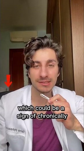 CLUBBED NAILS - explained 💅