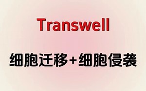 终于有人把Transwell实验说清楚了