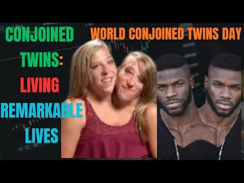 World Conjoined Twins Day