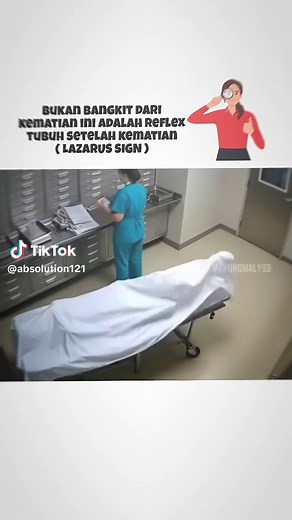 Lazarus sign: refleks tulang belakang pada pasien mati otak