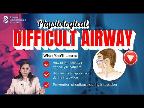 Physiological Difficult Airway | ICU Intubation in Critically ill Patients | Dr. Swati