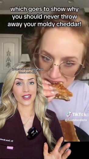 Can You Safely Eat Moldy Cheese? Expert Insights