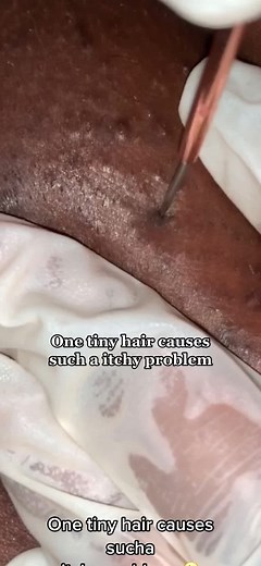 #extractions #galaxyextraction