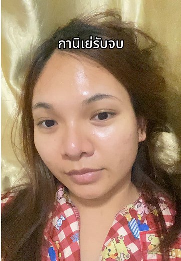 วิธีเลือกครีมกานิเย่เพื่อรักษารอยสิว