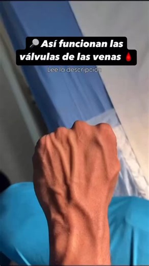 Crece Médico🩺 on Instagram: "¿Alguna vez te has preguntado cómo funcionan las válvulas de las venas? Las válvulas venosas juegan un papel crucial para ayudar a que la sangre regrese al corazón, especialmente desde las partes más bajas del cuerpo. Así es como trabajan: 📌 Función de las válvulas venosas: - Flujo unidireccional: Son estructuras en forma de aleta que permiten que la sangre fluya en una sola dirección, situadas dentro de las venas, sobre todo en las extremidades. - Previenen el ref