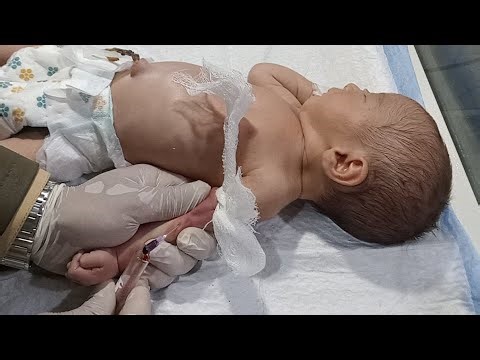 Newborn Blood Test Procedure in NICU | Safe Sampling | Nurse Training