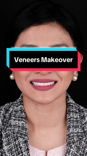 Good vibes only this weekend ✨ Featuring an #Apostolified smile makeover that says happiness looks good on everyone. #smile #happy #dentistry #veneers