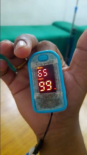 PR bpm normal range..