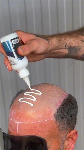 A hairline so natural, you won’t even notice where your bio hair ends.🔥✨ #wig #hairsystem #hairpiece #foryoupage #toupee