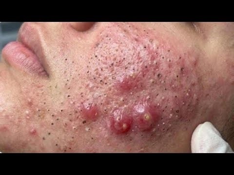 𝑨𝒄𝒉𝒊𝒆𝒗𝒆 𝑰𝒏𝒏𝒆𝒓 𝑷𝒆𝒂𝒄𝒆 𝑾𝒊𝒕𝒉 𝑻𝒉𝒆𝒔𝒆 𝑭𝒂𝒄𝒊𝒂𝒍 𝑪𝒍𝒆𝒂𝒏𝒔𝒊𝒏𝒈 𝑴𝒆𝒕𝒉𝒐𝒅𝒔 #4457423