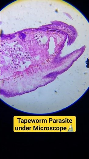 Tapeworm parasite under #microscope #tapeworm #physicswallah #biology #unacademy #adre