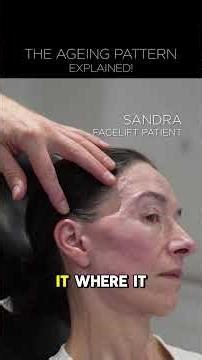 The ageing pattern explained