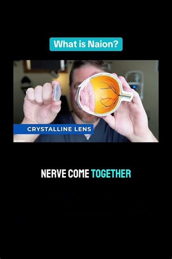 Why Ozempic Users Are Losing Their Sight #weightloss #health #warning