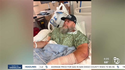Carpenter survives near amputation after a machete road rage attack in Carlsbad