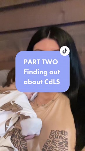 Understanding Cornelia de Lange Syndrome in Children: A Parent's Journey