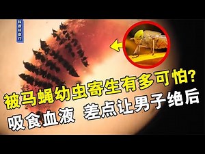 被马蝇幼虫寄生有多可怕？在男子体内生长繁殖，差点让其绝后！【科普任意门】