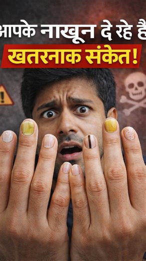 VedaRoots 🌿 | Your nails are not just for beauty — they are a powerful mirror of your internal health. This image highlights how changes in nail color,... | Instagram