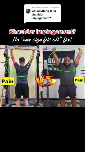 Shoulder Impingement: Screening and Treatment Methods