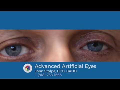 Motion of a Prosthetic Eye in an Enucleated Eye Socket, Incorporating a Digital Iris