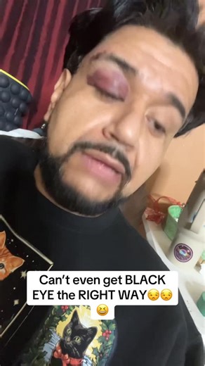 Edgar Garcia on Instagram: "Like really?!!!Got into fight with the table and it WON!😩… lame!!!! #fypシ #parati #fyp #foryoupage #foryou"