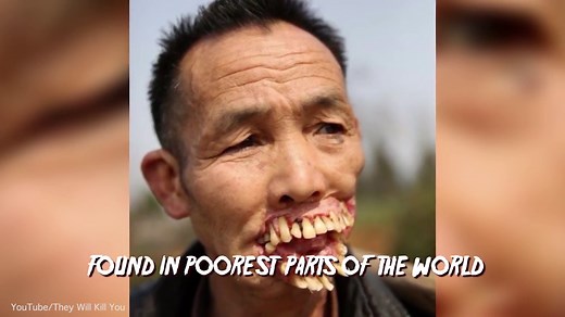 Check out the top 10 scariest diseases