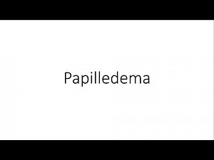 Papilledema - Ophthalmology