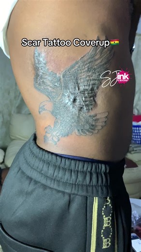 Scar Tattoo Coverup Techniques by Ghana Tattoo Artist