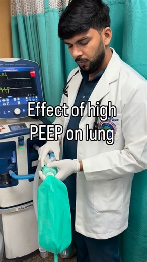 Dr.Vivek on Instagram: "PEEP isn’t just a number — it’s lung mechanics in real time. This is what increasing PEEP actually does to the lung. Every click of that dial changes oxygenation, compliance, and ultimately — the patient’s fate. PEEP is powerful, but only when used with physiology in mind. Watch carefully. #EmergencyMedicine #CriticalCare #VentilatorManagement #PEEP #ARDS #MedicalReels #DoctorReels #MedEd #ICUDoctor #ResidentLife #MedPG #LungMechanics #VentilatorSettings #Physiology #Anes