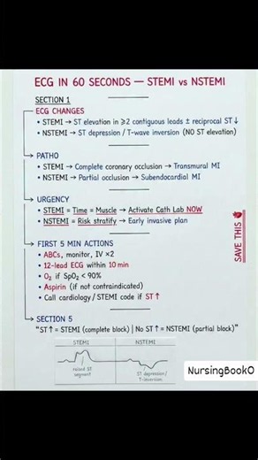 ECG (Electrocardiogram) Explained in Short | Heart Electrical Activity | Nursing Medical Basics