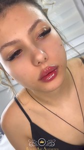 Lips  Nu uitați ultimele 2 zile de oferta 1 ml ha doar 199€ redus de la 290€ ✅ Tu te-ai programat? 0722.296.007 | Clinica Beauty Art Aesthetics | Facebook