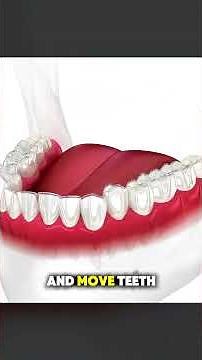 How Invisible Teeth Aligners Are Placed on Teeth | Step-by-Step Clear Aligners Guide #ClearBraces