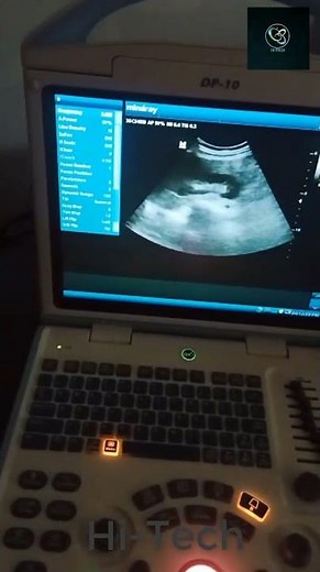 Mindray DP 10 Ultrasound Machine | How to use | Checking | Hi-Tech Engineering Ly