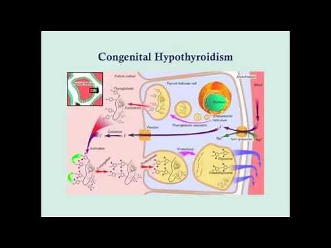 Newborn Endocrine Disorders - CRASH! Medical Review Series