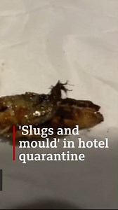 389K views · 2.7K reactions | “When I pulled my foot back, I picked up a clump of hair that was not mine.” Passengers travelling to the UK from red list countries have slammed their “prison-like” experience in government-approved quarantine hotels, where they have reported everything from filthy rooms to poor quality food. https://bbc.in/3CJ943V | BBC News | Facebook