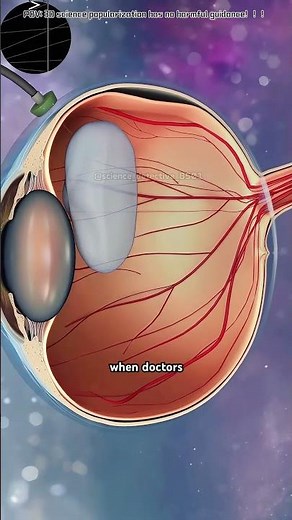 How Vitrectomy Surgery Is Done (3D Animation)#Vitrectomy#EyeSurgery#EyeHealth#medical3danimation