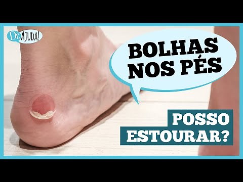Blisters on the Feet🦶: How to Treat and How to Prevent? #feet #blisters"