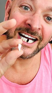 Broken tooth! 🦷 (Prank! 🤣) | Neil Henry