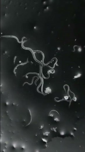 dust in our nails in microscope view #shorts #microscope #nails #germs