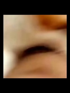 Cat bites man's leg.
