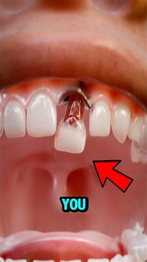 What REALLY Happens If You Accidentally Swallow a Tooth?