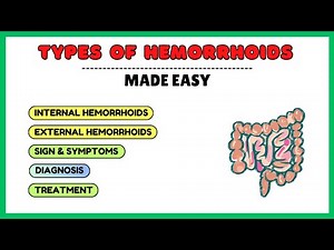 Types of Piles (Hemorrhoids) Explained | Internal vs External, Symptoms & Treatment