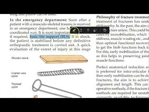 Orthopedics 034 General Principles Of Fracture Management How to treat handle what to do emergency
