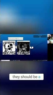 Master Image Segmentation Fill Holes, Watershed & Fix Over Segmentation!