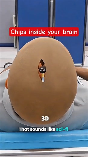 Do You Know Humans Are Already Being Implanted With Chips? 😱🧠