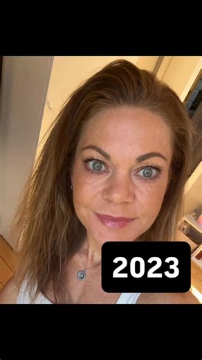 Helene Valeur on Instagram: "Der er rigtig mange ting man skal vænne sig til når man er mig, og der er rigtig mange kameler man skal sluge🤷‍♀️🙄 men med tiden lærer man at håndtere det, en af de største udfordringer af alle, det er at kigge mig selv i spejlet, samt vise andre at nu ser jeg sådan her ud. Og jeg kan stadig blive overrasket over hvor god jeg er blevet til det 🙏 #stroke #takingbacklife #fight #goals #life"