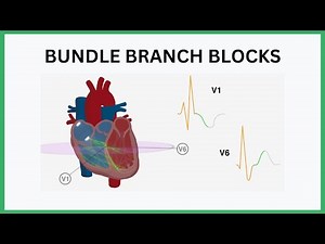 Bundle Branch Blocks Visualised