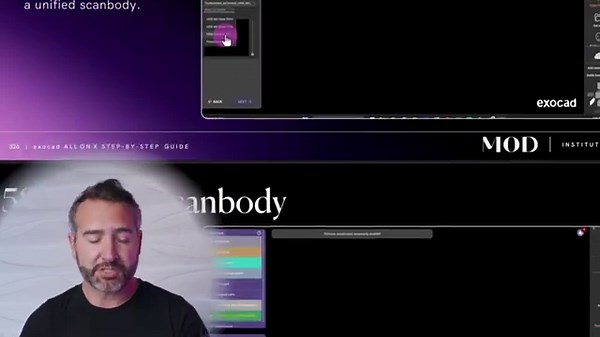 Free exocad all on x step by step guide : link in description