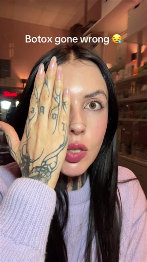 Botox Gone Wrong: A Cautionary Beauty Tale