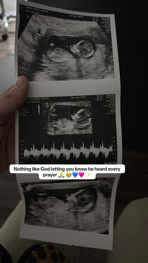 My miracle sent from heaven 💙✨🩷 #baby2#sptemberbaby#2026baby#fyppppppppppppppppppppppp#blessed